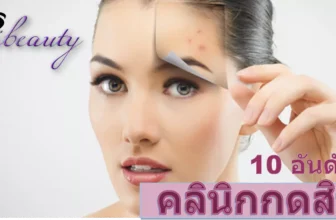 บอกลาสิว ปัญหาหน้าไม่เนียน แนะนำเลย 10 คลินิกกดสิว ราคาย่อมเยาว์ ในปี 2026
